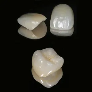 Veneers & Crowns Differences | Cosmetic Dentistry Garden City Veneers & Crowns Differences | Cosmetic Dentistry Garden City